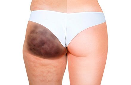 biopolimeros antes despues main.jpg